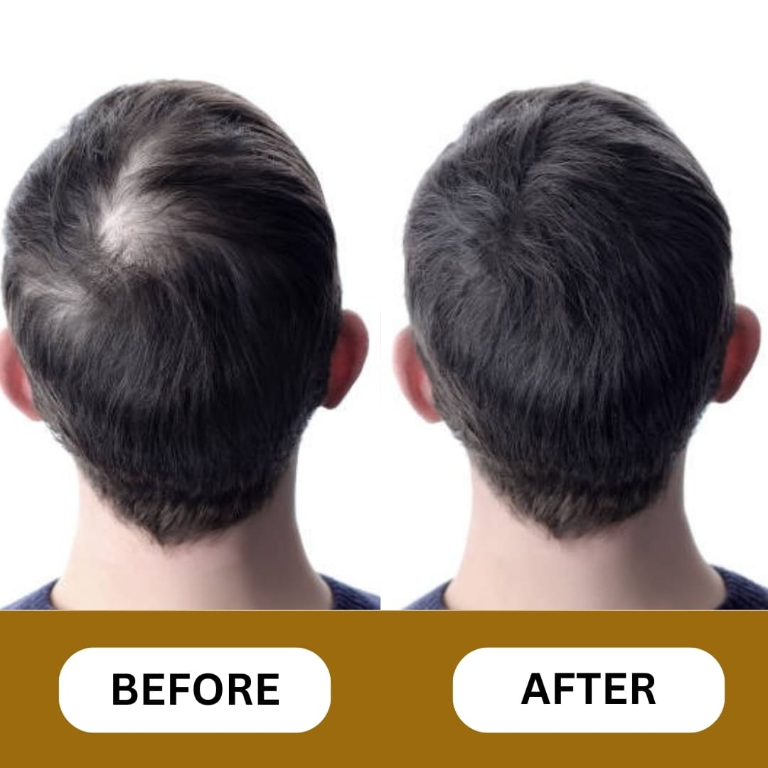 Hair Growth Serum - Advanced Formula 50ml