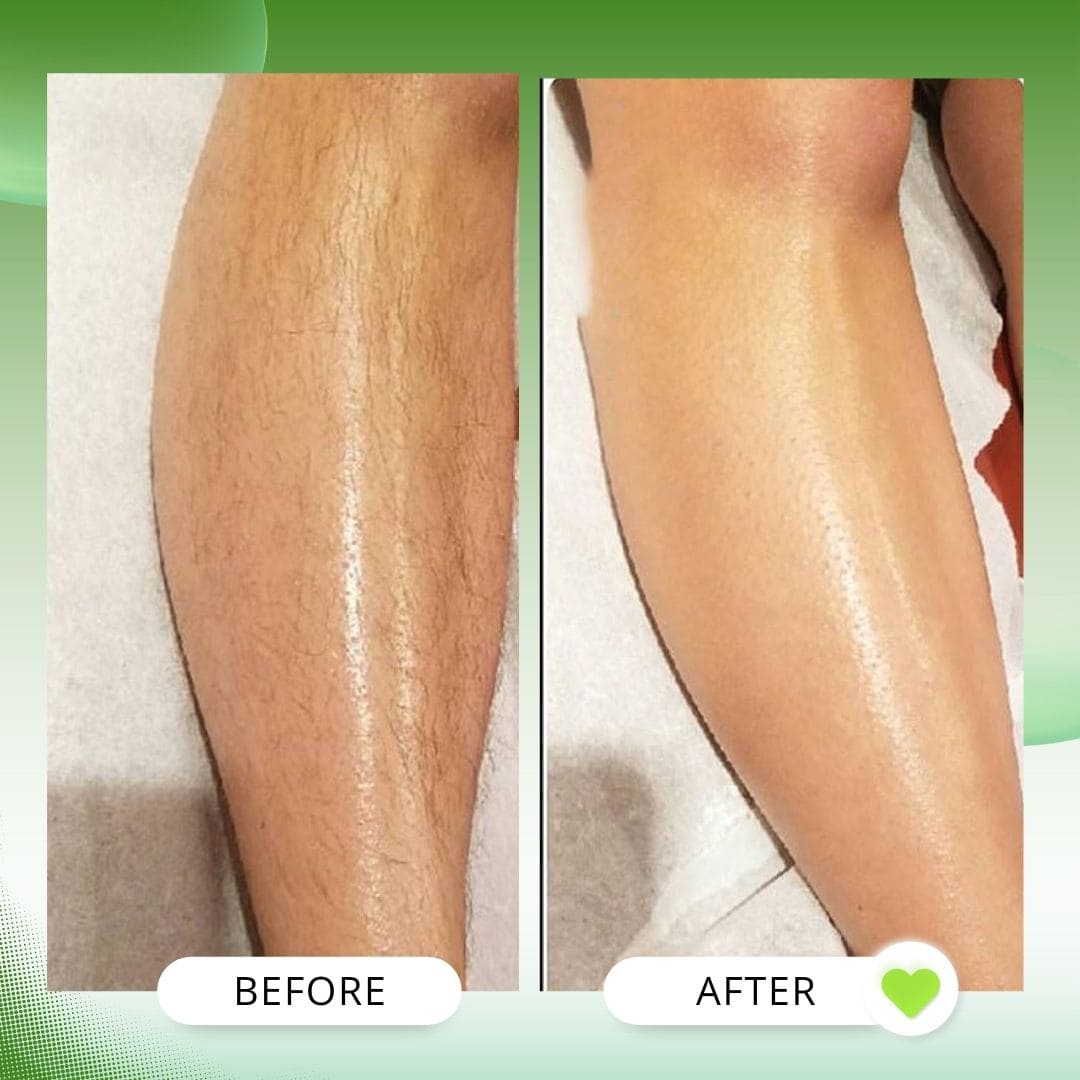 Body Hair Removal Pack
