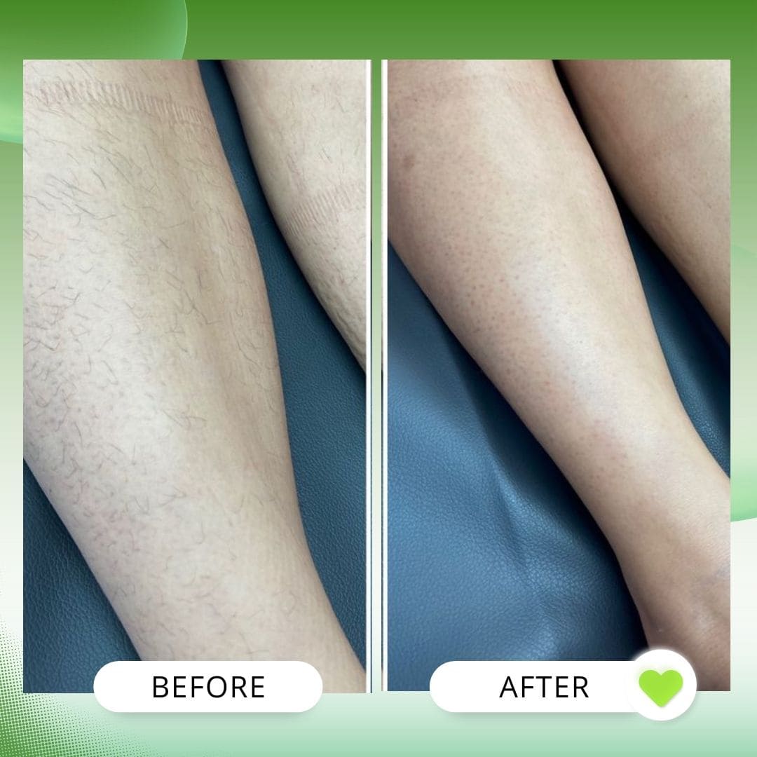 Body Hair Removal Pack