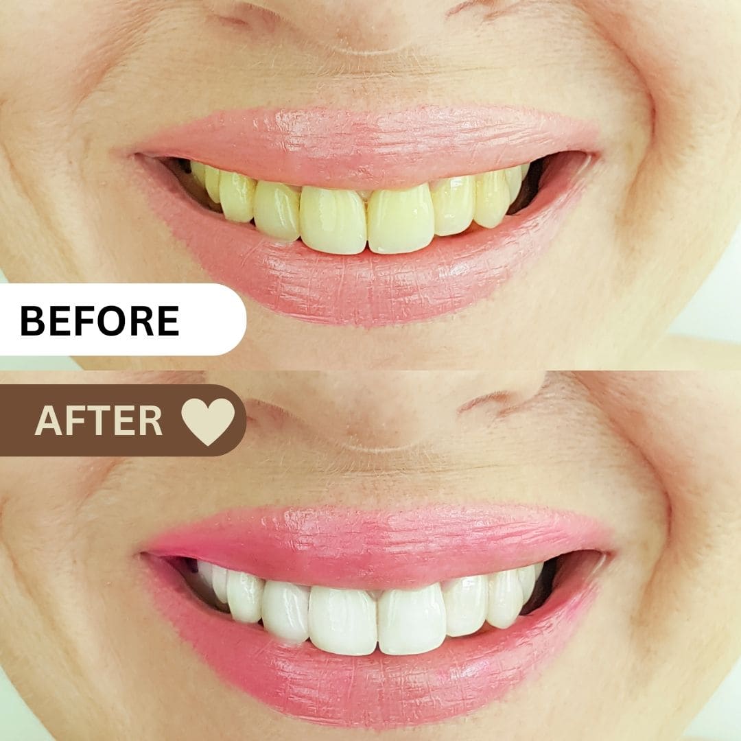 Natura bright - Teeth Whitening Powder